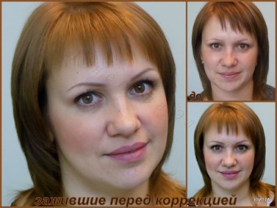 элитт.jpeg