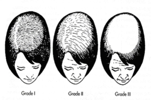 female type.jpg